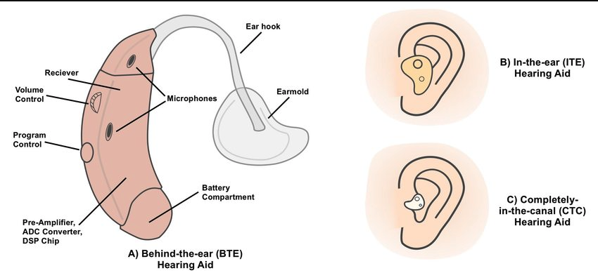 For Parents - Types of Hearing Aids - cochlear implants - schools for hearing impaired - schools for hearing impaired