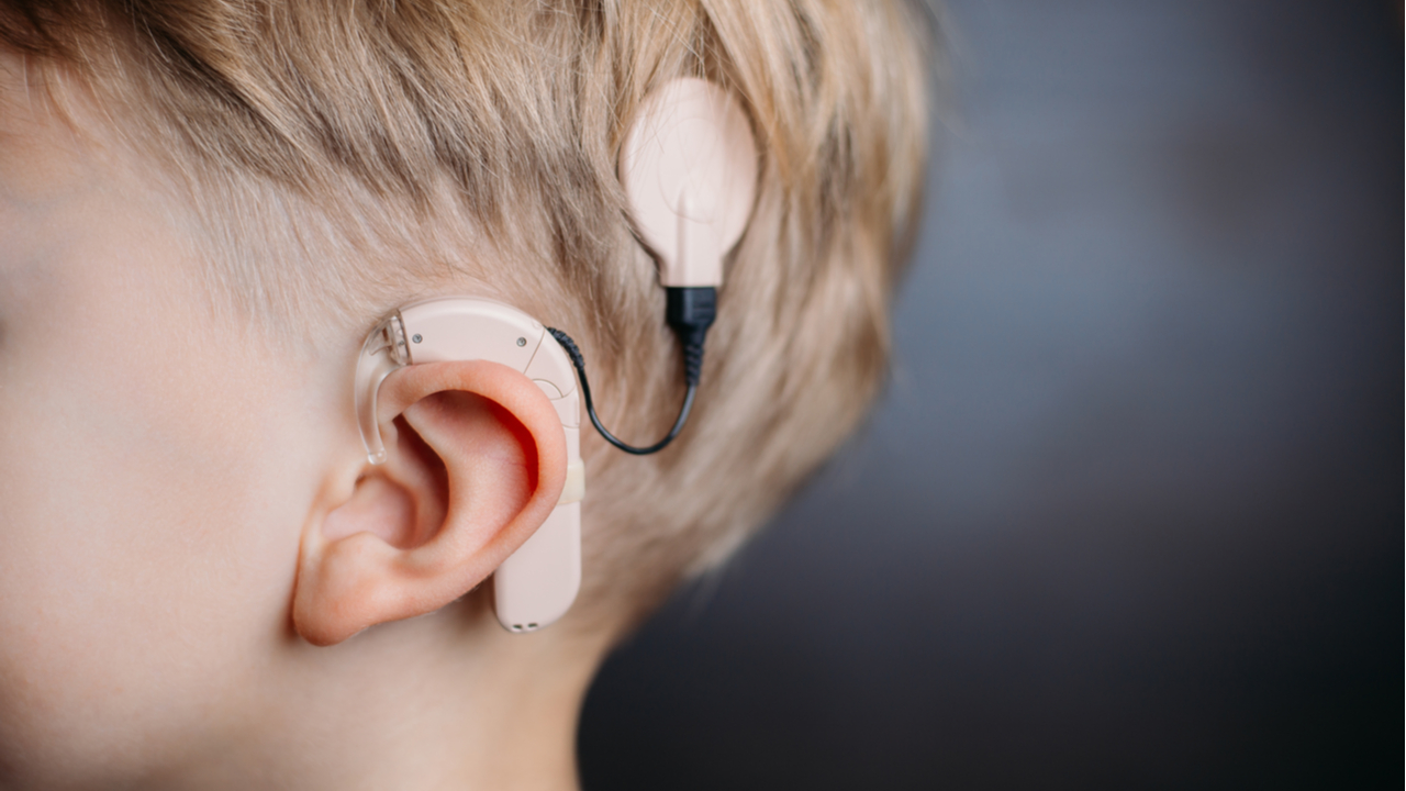 For Parents - Cochlear Implants - laws for children's rights in india - schools for hearing impaired - instructional aids