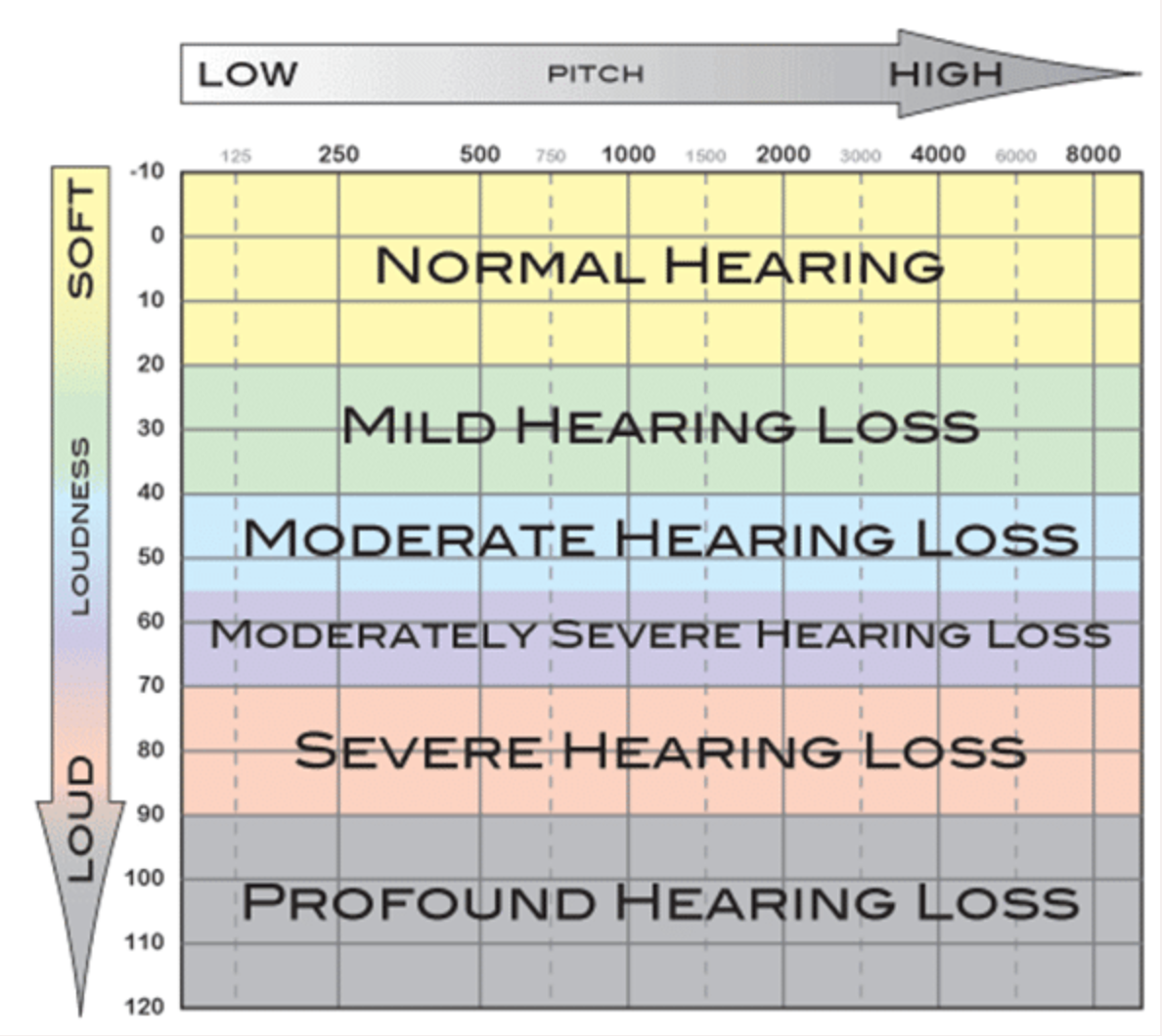 05 hearing loss levels